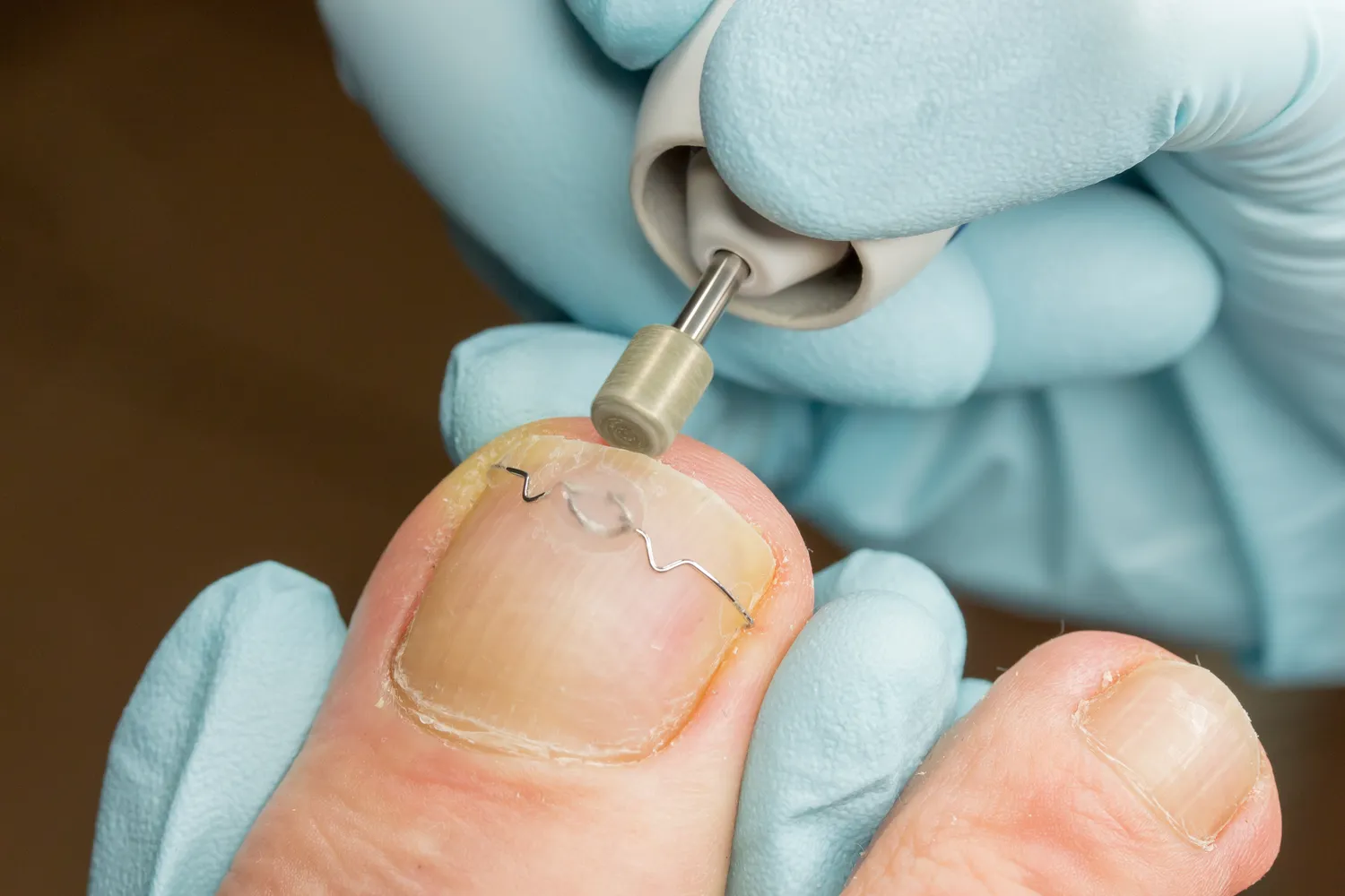 Podolog - co warto wiedzieć o tej profesji?