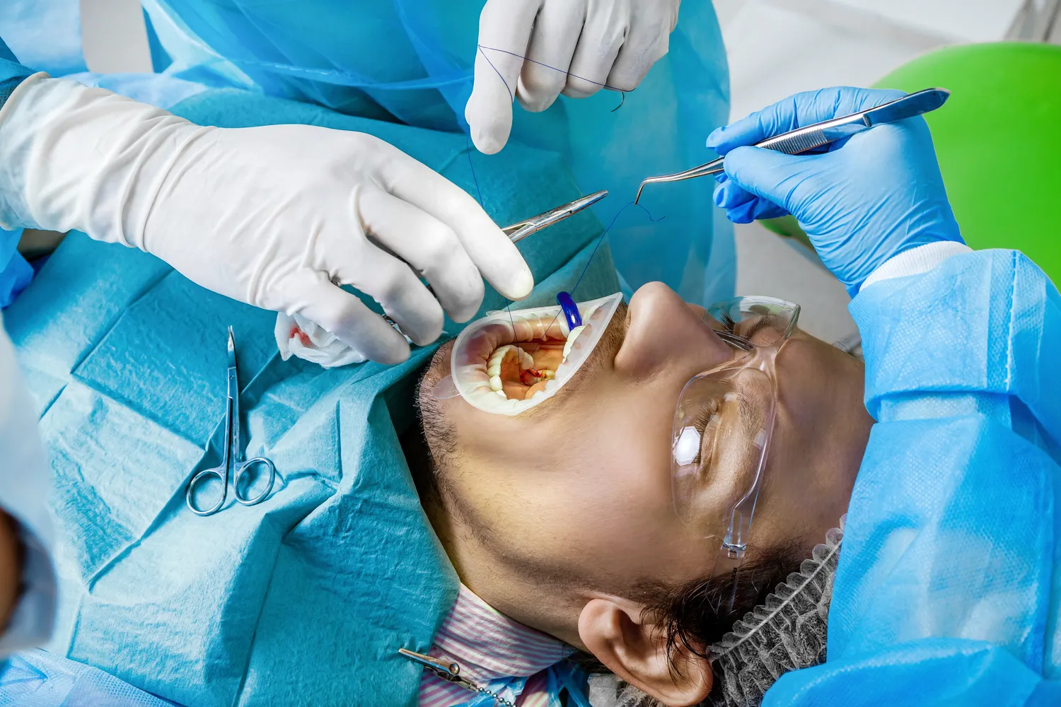 E recepta jak wygląda?