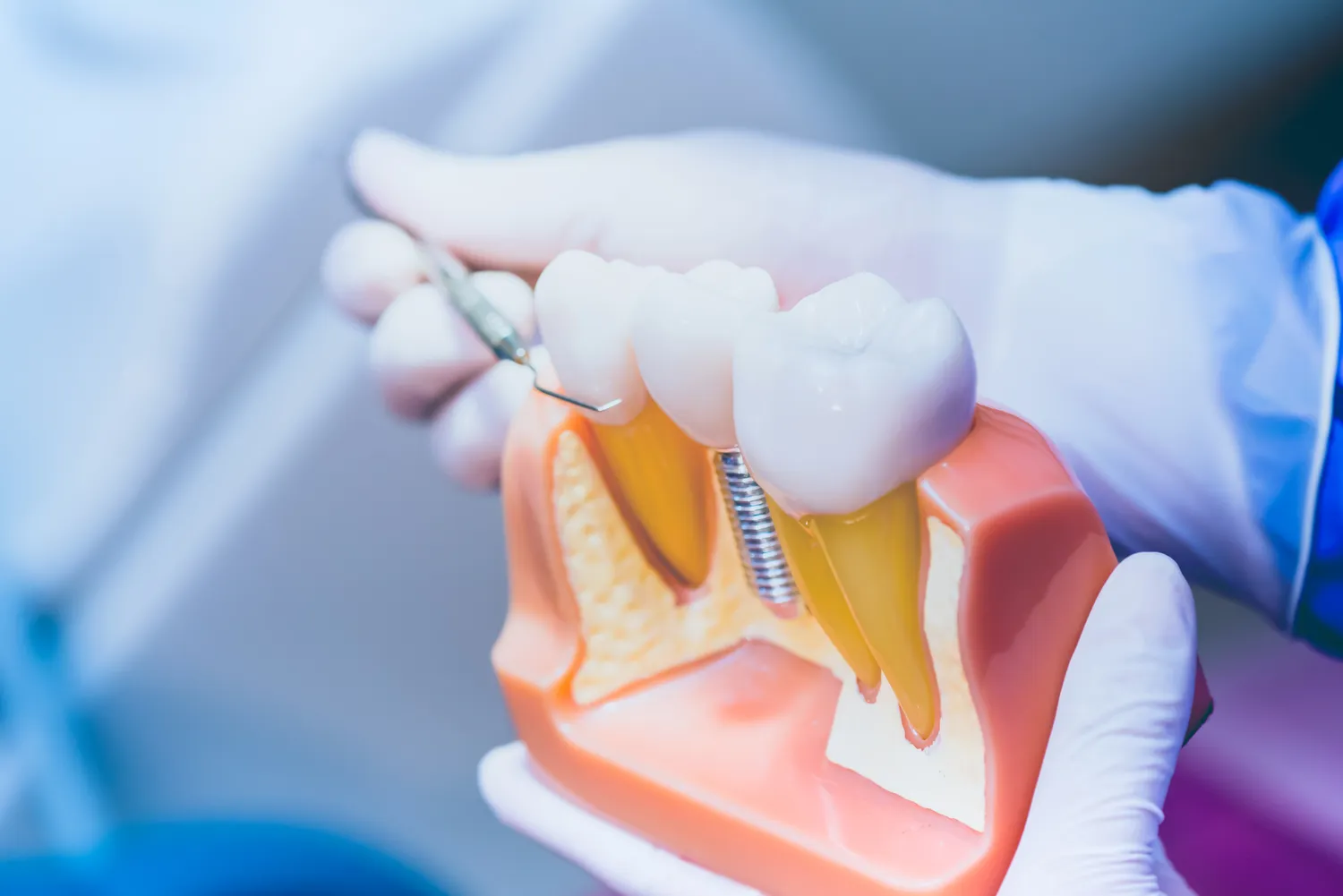 Najlepszy dentysta Warszawa