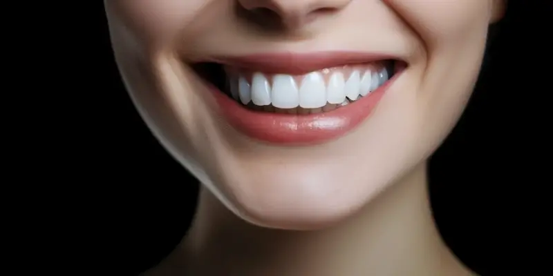 Co to są licówki na zęby i ile kosztują?