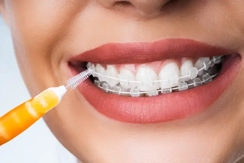 Powszechne zabiegi w stomatologii